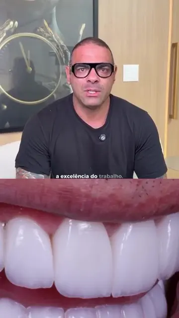 Capa do vídeo 3 da Clínica Viotto Belo Horizonte