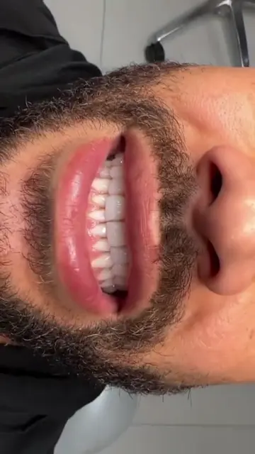 Capa do vídeo 5 da Clínica Viotto Belo Horizonte